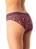 Figi Key LPR 706 B25 S-XL A'2